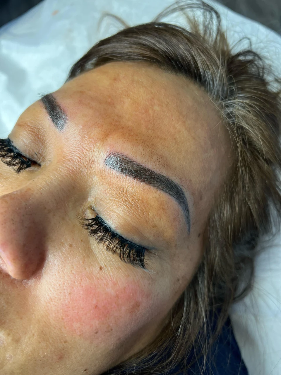 Angled view of a client’s face showing both brows.